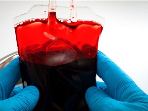 Theo dõi số liệu máu toàn cầu có thể ngăn chặn đại dịch tiếp theo?