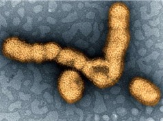 Khi nhỏ mắc cúm H1N1, lớn lên khó bị nhiễm cúm H3N2