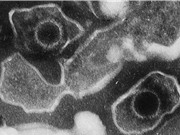 Phát hiện cấu trúc nguyên tử đầu tiên của virus gây herpes