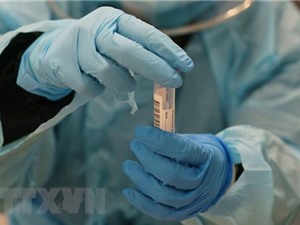 Dịch COVID-19: Thụy Sĩ phát hiện virus SARS-CoV-2 trong da người