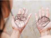 Covid-19 có thể gây ra chứng rụng tóc