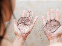 Covid-19 có thể gây ra chứng rụng tóc