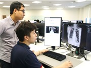 Thi ứng dụng AI phát hiện điểm bất thường trên ảnh X-quang lồng ngực người Việt