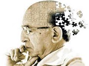 Phương pháp mới chẩn đoán bệnh Alzheimer với độ chính xác 90%