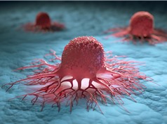 "Cân" tế bào ung thư để lựa chọn thuốc điều trị phù hợp