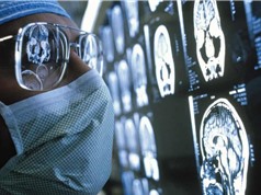 Thử nghiệm siêu âm mang lại hy vọng cho bệnh nhân ung thư não