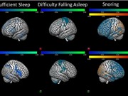 Ngủ không đủ giấc có hại cho não của trẻ em
