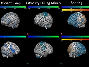 Ngủ không đủ giấc có hại cho não của trẻ em