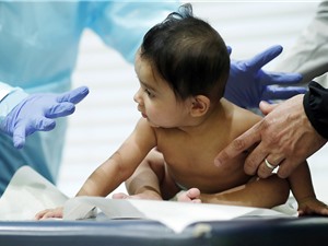 Đại dịch có thể làm trẻ sơ sinh chậm phát triển