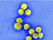 Tìm nguyên nhân khiến virus SARS-CoV-2 lây lan mạnh hơn SARS-CoV-1