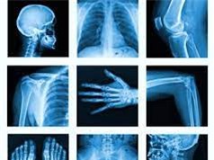 Phương pháp mới giúp đánh giá tuổi xương và xác định giới tính từ ảnh chụp X quang