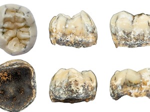 Hóa thạch răng hàm tìm thấy ở Lào có thể thuộc về người Denisova 