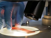 Liệu pháp gen làm giảm nguy cơ chảy máu ở bệnh nhân máu khó đông