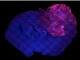 Bộ não lai: Cấy ghép tế bào thần kinh của người vào não động vật