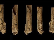 Ca phẫu thuật chi sớm nhất được thực hiện cách đây khoảng 31.000 năm