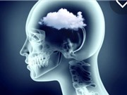 Phát hiện nguyên nhân khiến COVID-19 gây ra sương mù não