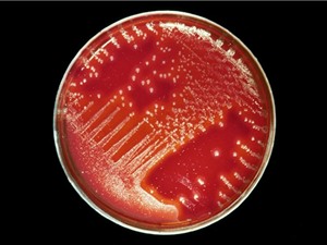 Anh: Số ca nhiễm liên cầu khuẩn nhóm A trái mùa tăng bất thường