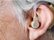 Máy trợ thính giúp giảm nguy cơ sa sút trí tuệ ở người mất thính lực