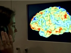 Nghiên cứu bộ não - Đầu óc thông minh giải đố chậm hơn