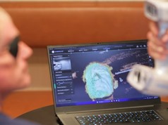 [Video] Ứng dụng in 3D trong sản xuất mắt nhân tạo