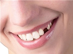 Phát triển loại thuốc giúp mọc lại răng