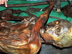 Người băng Ötzi có trán hói và da màu