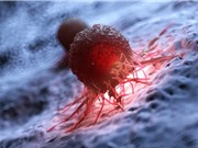 Vi khuẩn biến đổi gene phát hiện ung thư?