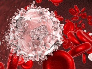 Ứng dụng các kỹ thuật theo dõi tái phát ung thư máu ở trẻ em