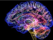 Cấy ghép não giúp phục hồi sau chấn thương nghiêm trọng