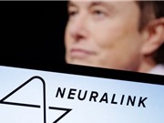 Neuralink thực hiện ca cấy ghép chip vào não người đầu tiên