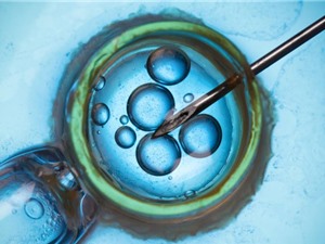 Công nghệ mới tạo ra phôi thai mang gene từ hai người đàn ông