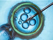 Thụ tinh ống nghiệm từ tế bào da: Cơ hội cho người vô sinh
