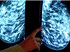 Thiết bị theo dõi ung thư vú gắn trong áo ngực