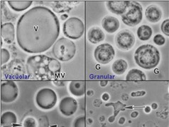 Vi sinh vật đường ruột Blastocystis: Hóa giải những tranh cãi