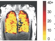 Phương pháp mới cho phép quan sát tức thời hiệu quả điều trị chức năng phổi 