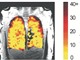 Phương pháp mới cho phép quan sát tức thời hiệu quả điều trị chức năng phổi 