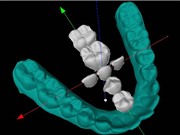 Xác định các gene quyết định hình dạng răng 