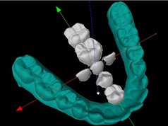 Xác định các gene quyết định hình dạng răng 