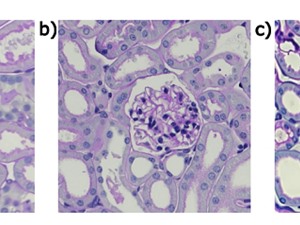 Tạp chí khoa học đau đầu vì hình ảnh y tế giả mạo từ AI 