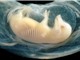 Lần đầu nuôi cấy tim người trong phôi lợn