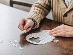 Công cụ AI phát hiện 9 loại sa sút trí tuệ chỉ từ một lần quét não