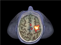 Não bộ kích hoạt tế bào miễn dịch khi có người bệnh ở gần