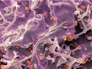 Vắc-xin HIV công nghệ mRNA kích hoạt phản ứng miễn dịch mạnh ở người