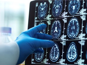 Não người lão hóa nhanh hơn trong đại dịch COVID-19