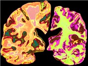 Bổ sung lithium giúp đảo ngược tình trạng suy giảm trí nhớ, theo nghiên cứu trên chuột