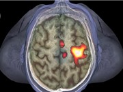 Chỉ cần đến gần người có bệnh cũng đủ khiến não kích hoạt tế bào miễn dịch 