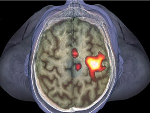 Chỉ cần đến gần người có bệnh cũng đủ khiến não kích hoạt tế bào miễn dịch 