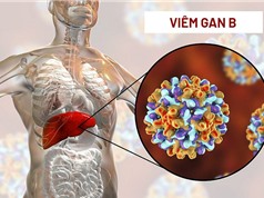 Nguy cơ khó loại trừ bệnh viêm gan B tại Việt Nam vào năm 2030