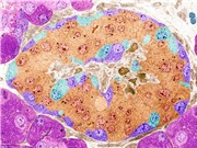 Tế bào chỉnh sửa gene cung cấp insulin và né hệ miễn dịch của cơ thể