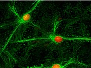 Phát hiện vùng não liên quan đến các cơn đau mãn tính